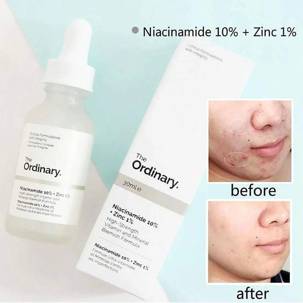 The Ordinary Niacinamide 10%+Zinc 1% -30ml Serum