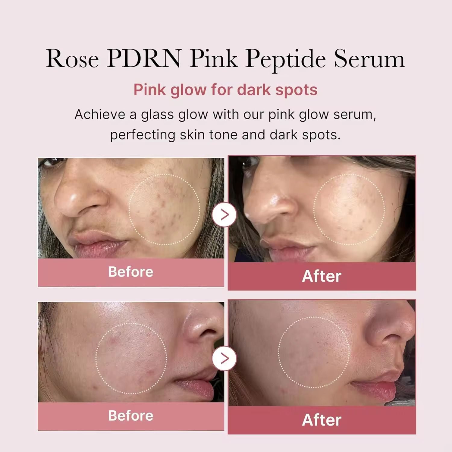 "Medicube PDRN Pink Peptide  30ml Serum | Glow, Firmness & Skin Repair"