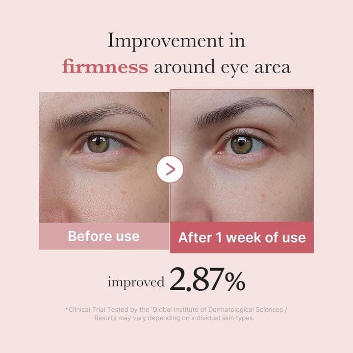 "Medicube PDRN Pink Peptide Eye Cream – Dark Circles & Wrinkle Care"